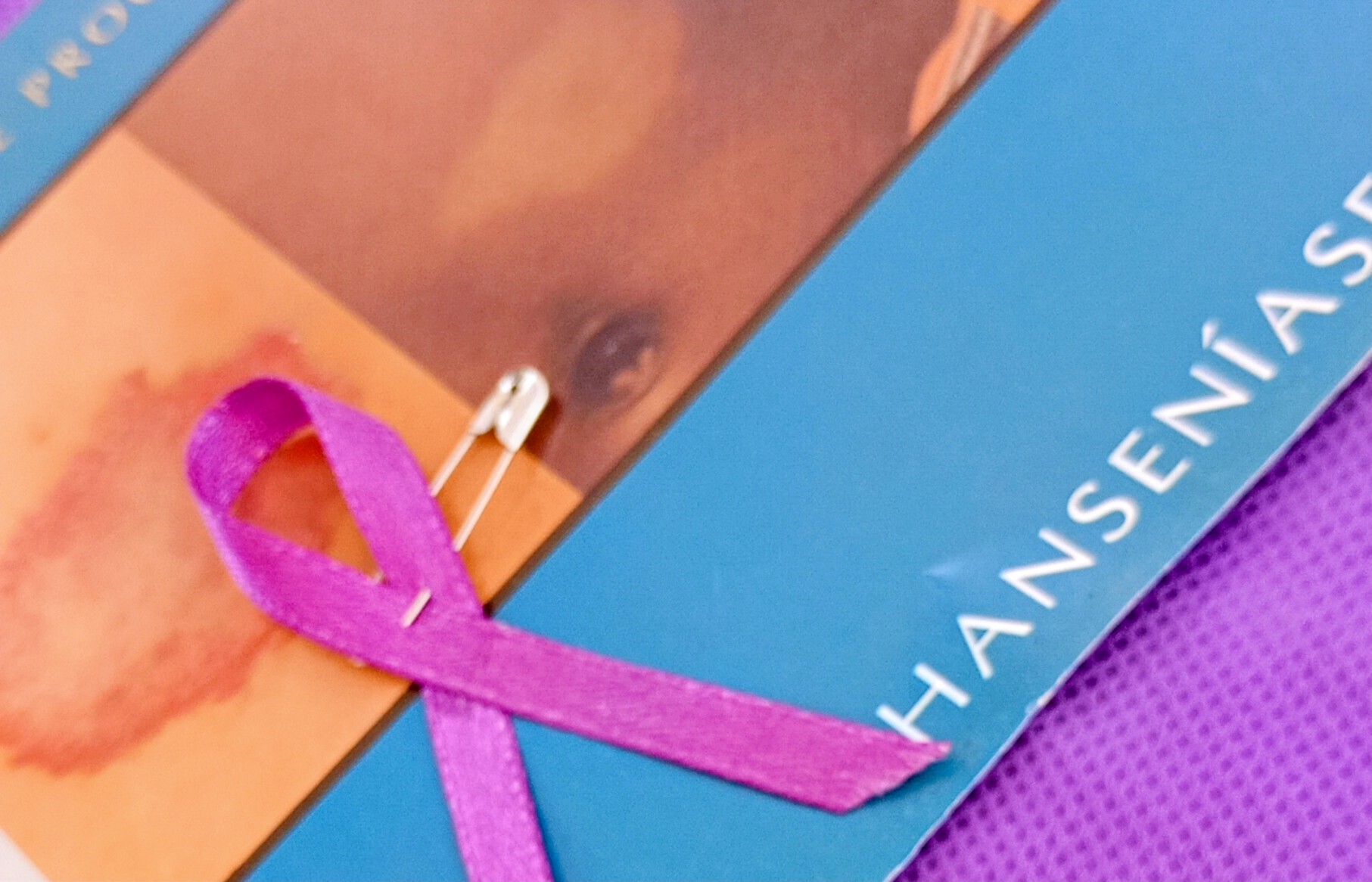 Janeiro Roxo: conscientização sobre hanseníase mobiliza população